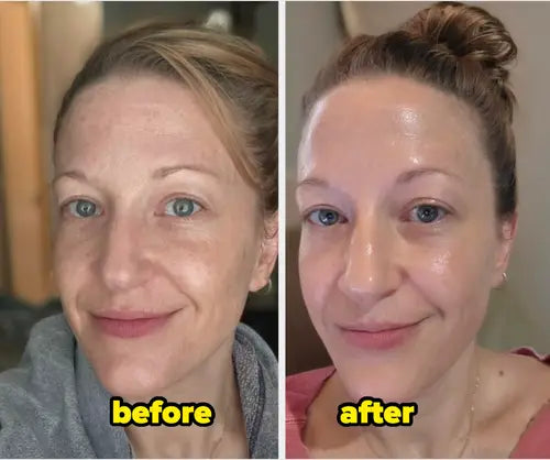 The Truth About Exfoliation: How Canadians Can Avoid Dry Skin