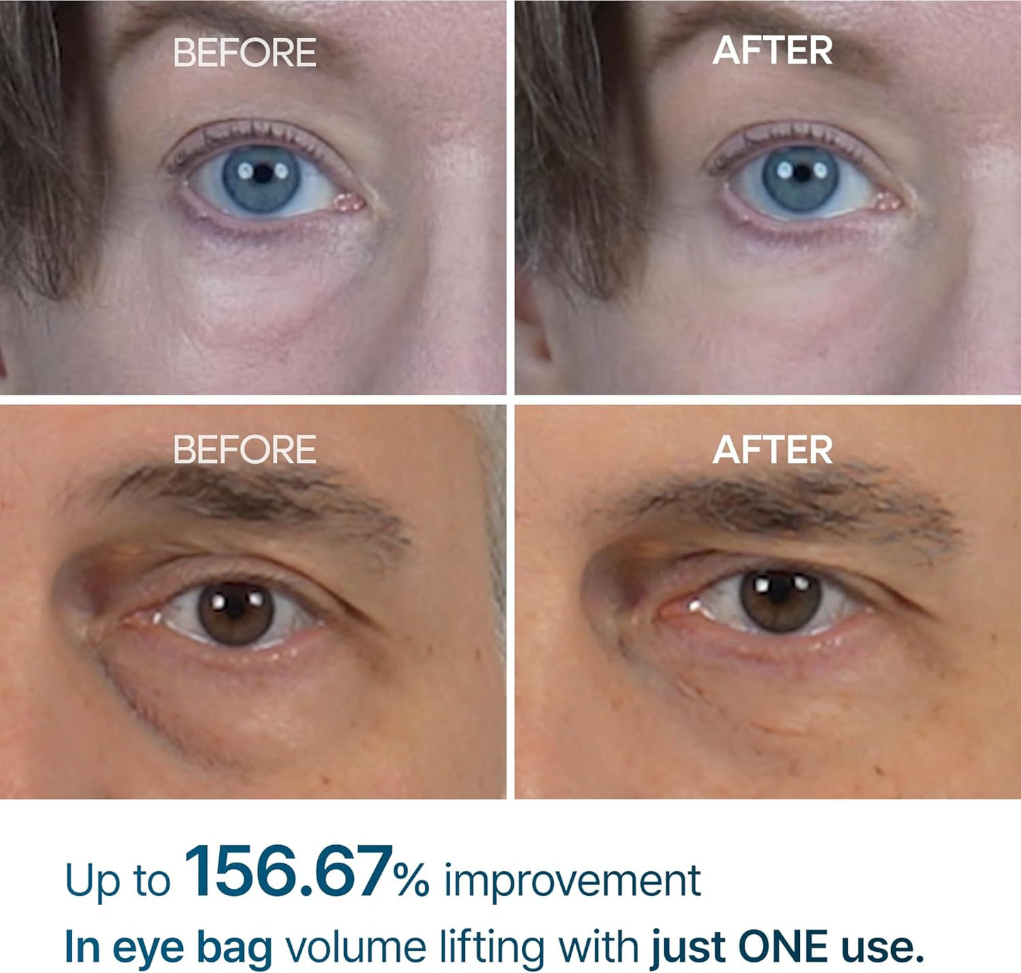 Eyephalt eyebag cream
