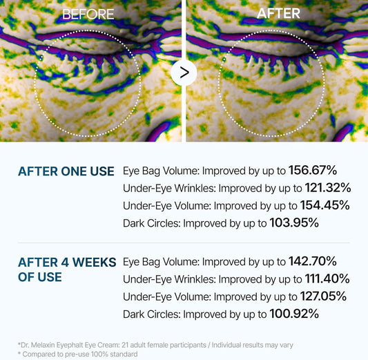 Eyephalt eyebag cream